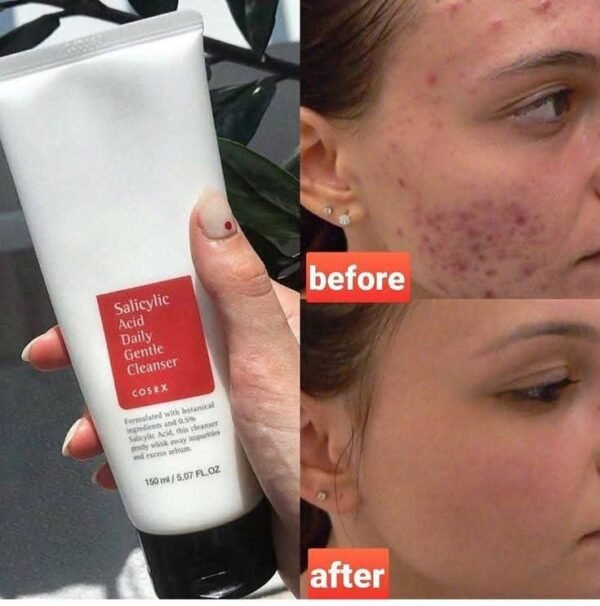 Cosrx salicylic acid cleanser - Image 3